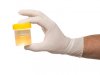 urine-drug-test.jpg