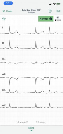 EKG slice.JPG